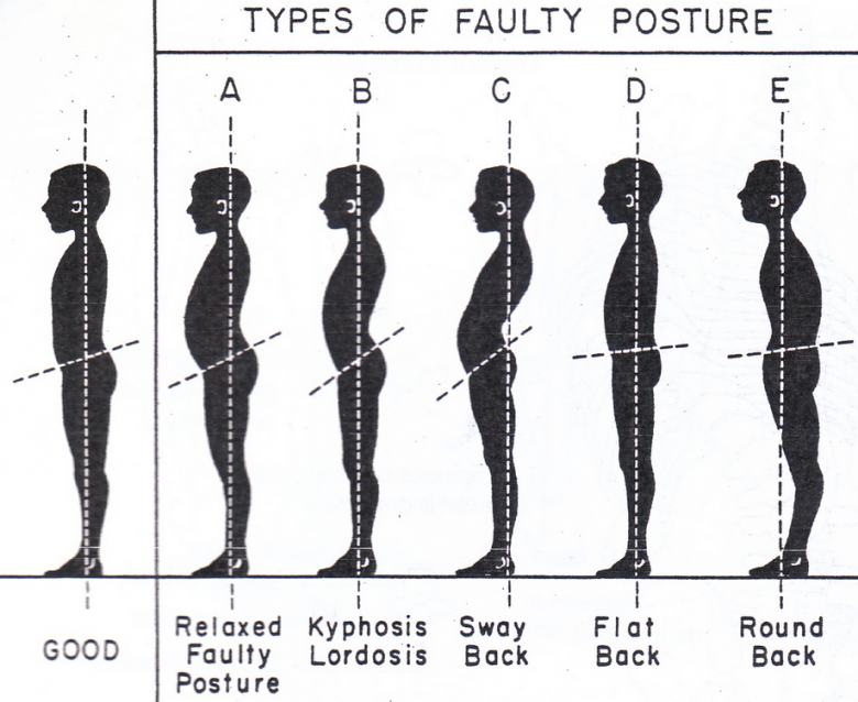 type of posture